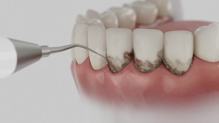 Reliable Dental contractor in Rib Mountain, WI by Smile Center Dentistry